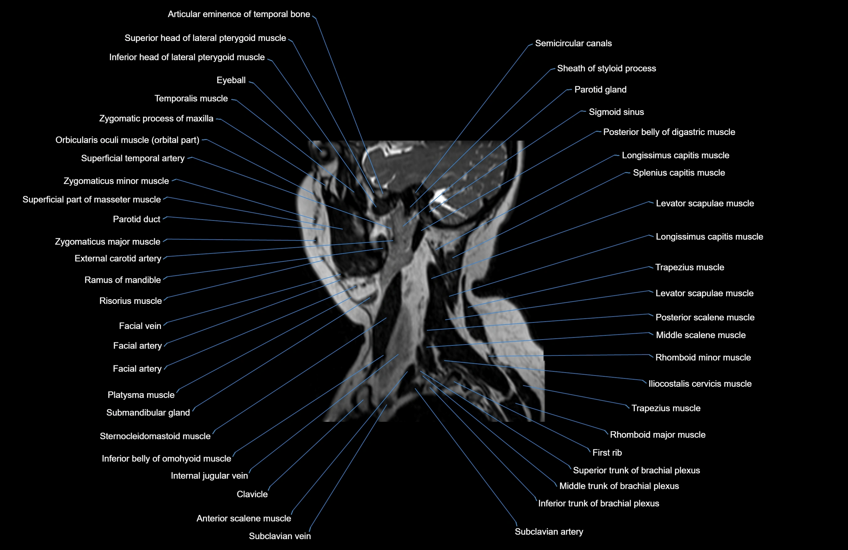 Neck MRI sagittal cross sectional anatomy 3D 1mm 3T radiology  image-img-00001-00027.webp